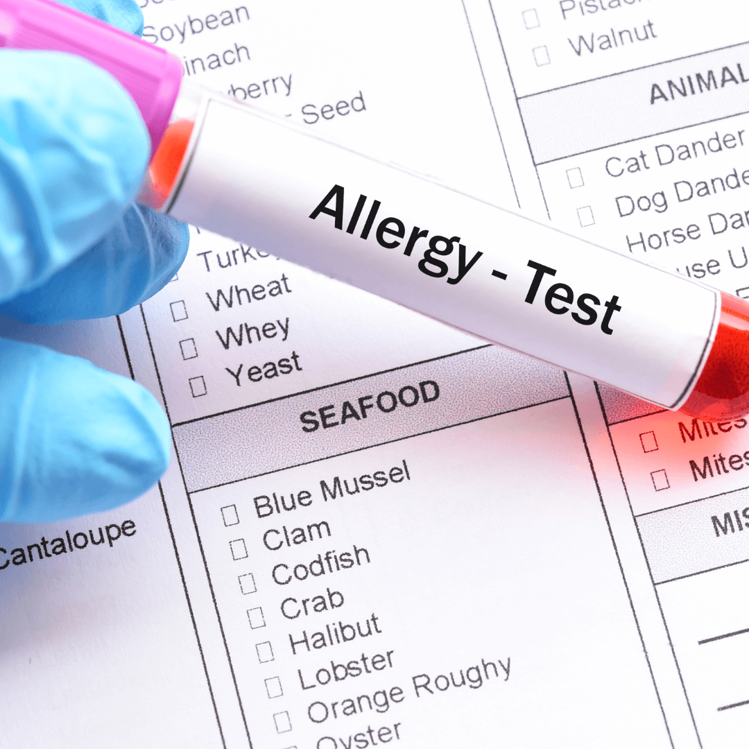 Food Sensitivity Testing