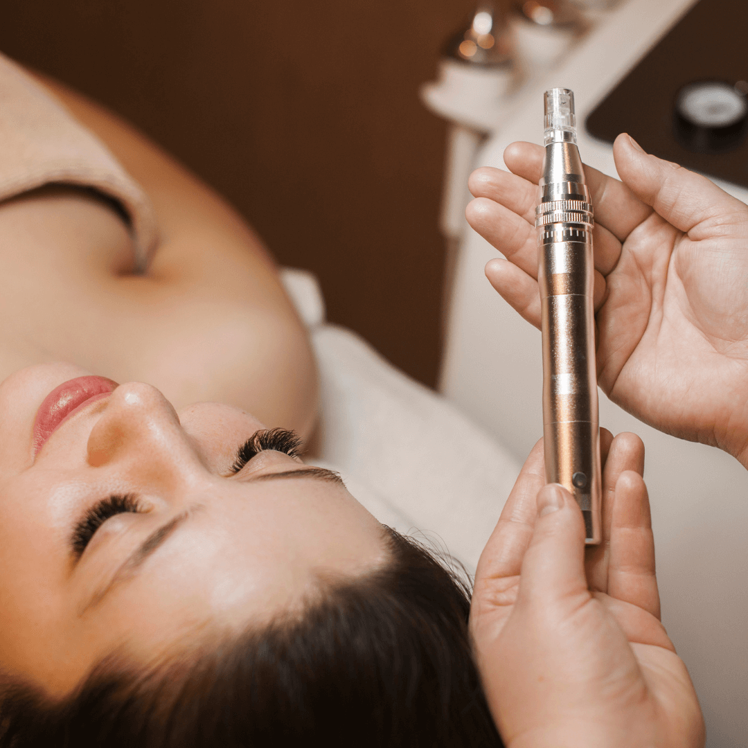 Microneedling